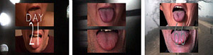 Tongue Diagnosis 2000/07 - A 99 day medical diary from Beijing